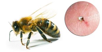 Part of the Hondrostrong are bee venom, which improves the metabolic processes in the tissues