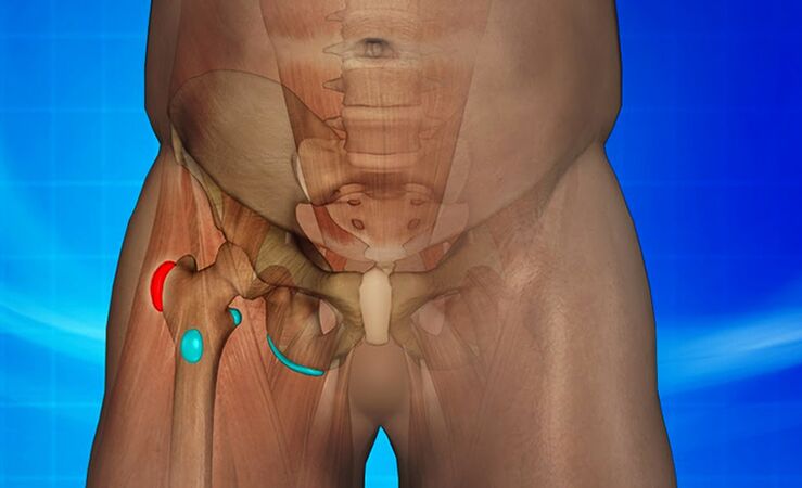 inflammation of the hip joint as the cause of pain